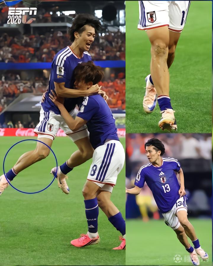 没戴护腿板？日本国脚中村敬斗佩戴超小号护腿板引发热议